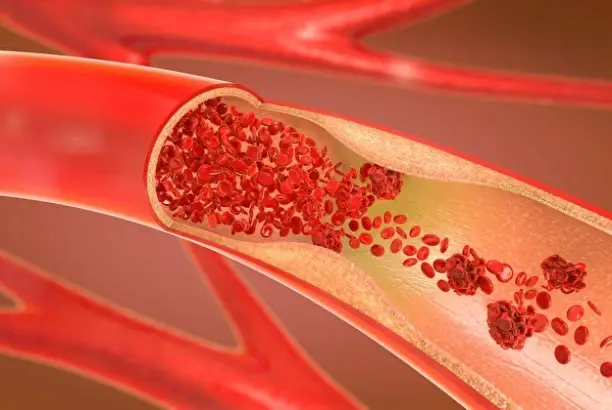 Cardiovascular Support Mechanisms
