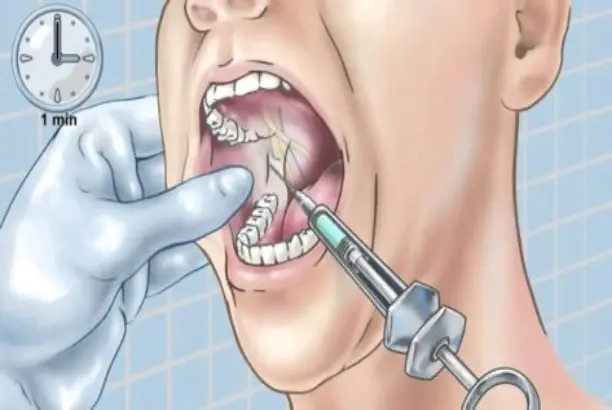 anesthesia