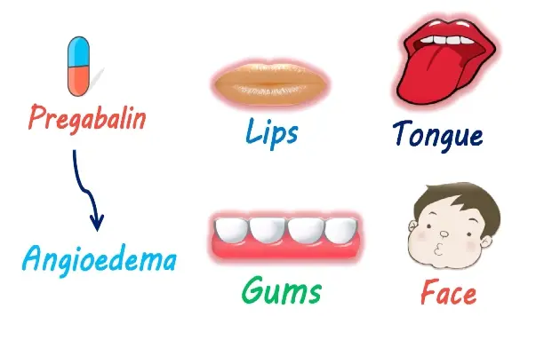 pregabalin used pregabalin used